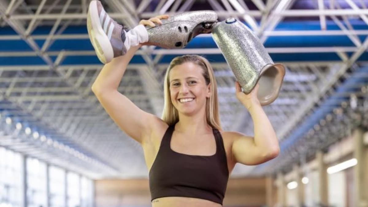 Desirée Vila: "En la tele se les olvidaba que me falta una pierna"