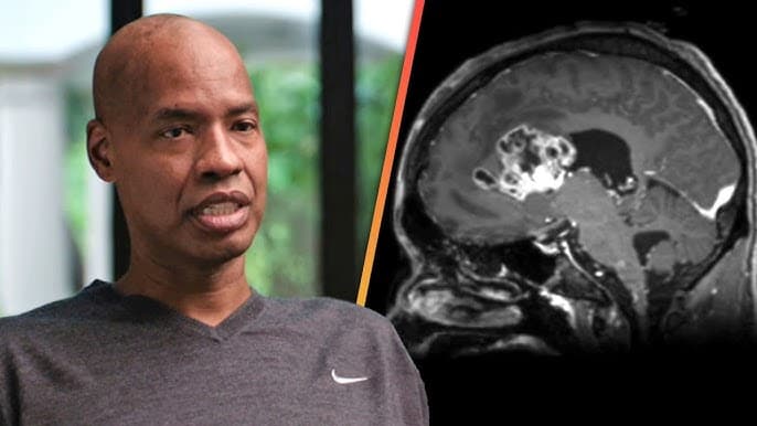 Así descubrió Jason Collins que tenía un tumor cerebral: "Me convertí en la versión de 'Dory'' de un jugador NBA"