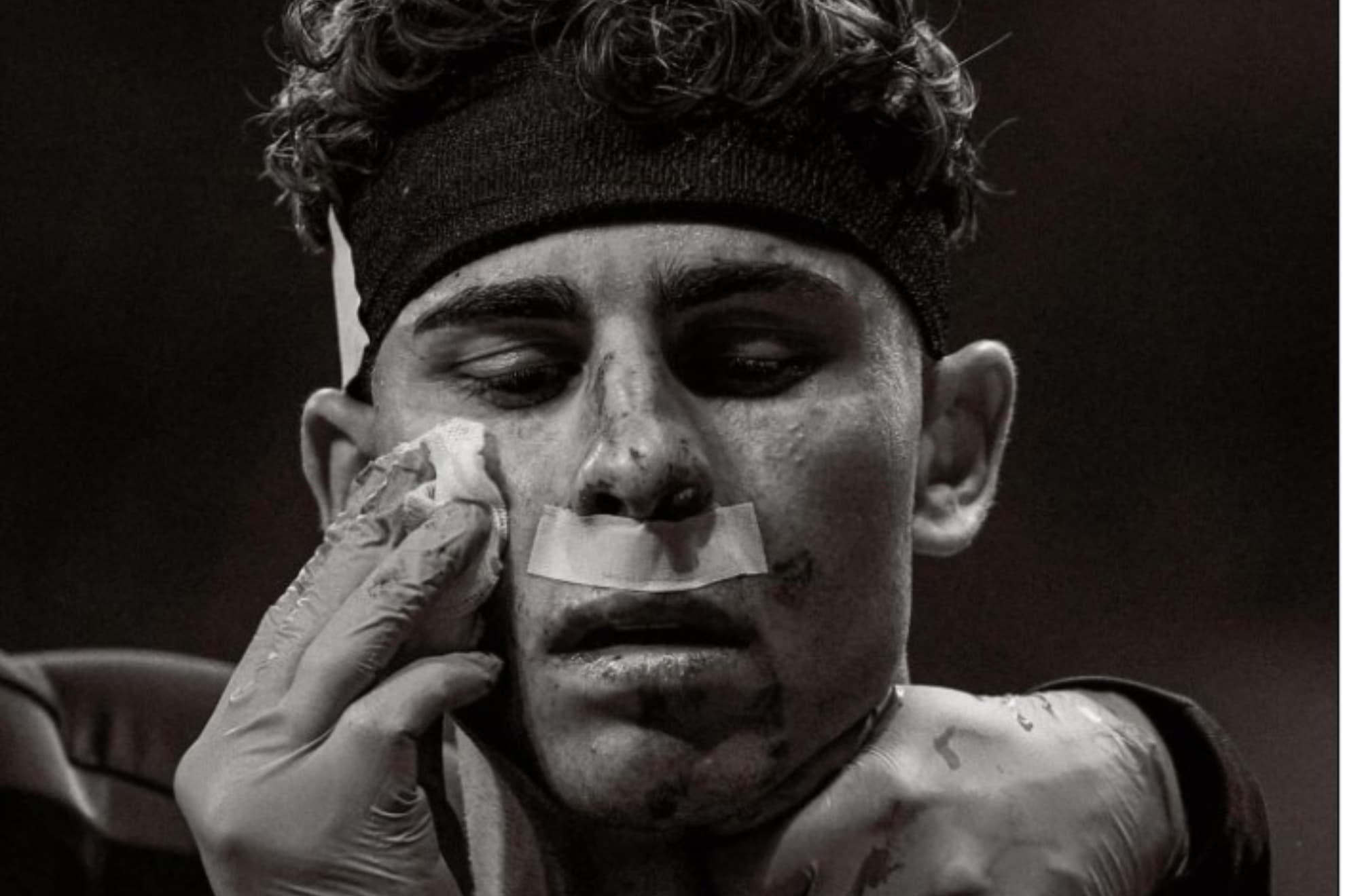 Fermín, tras sufrir el golpe con Musso.