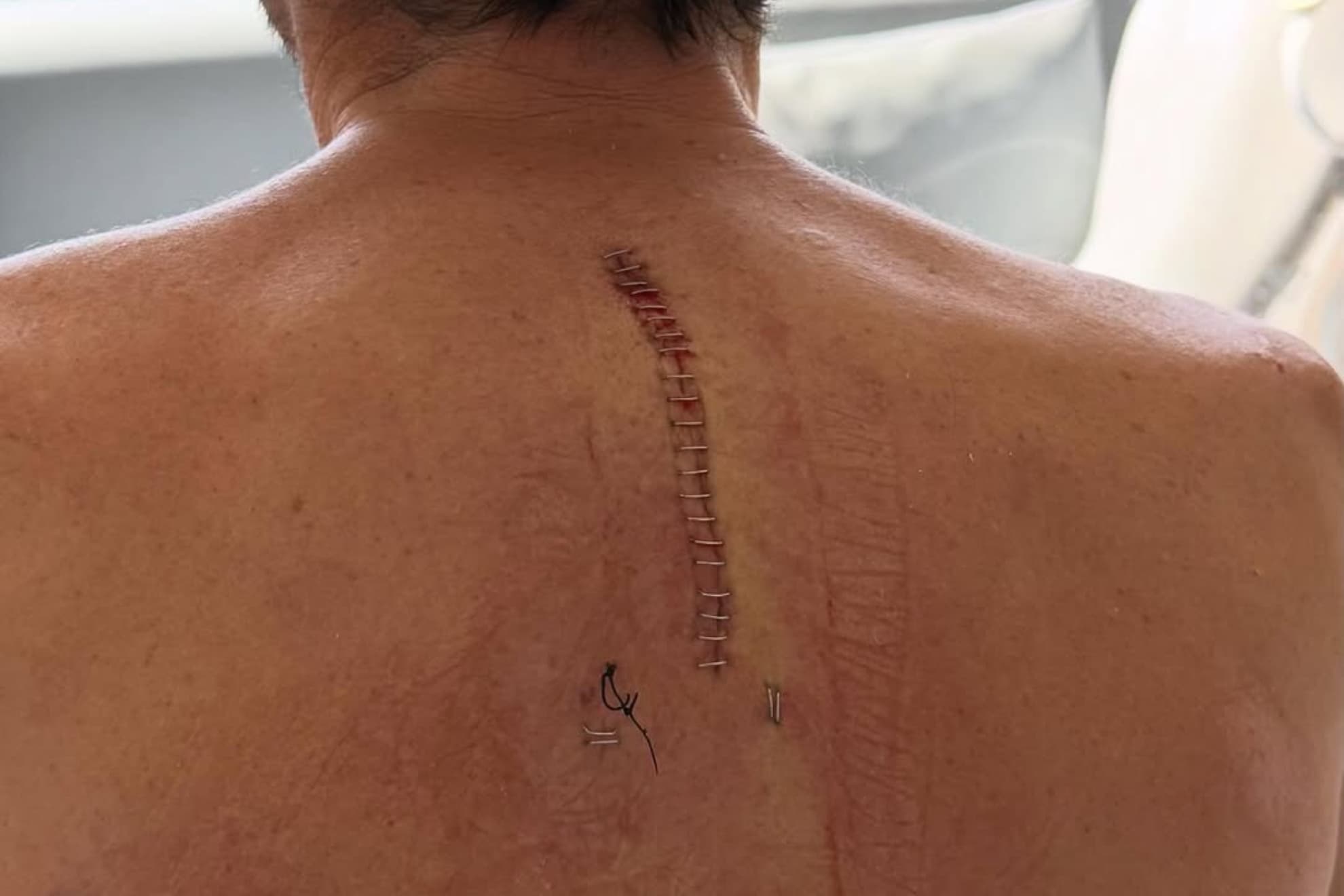 La espalda de Aleix Espargaró.