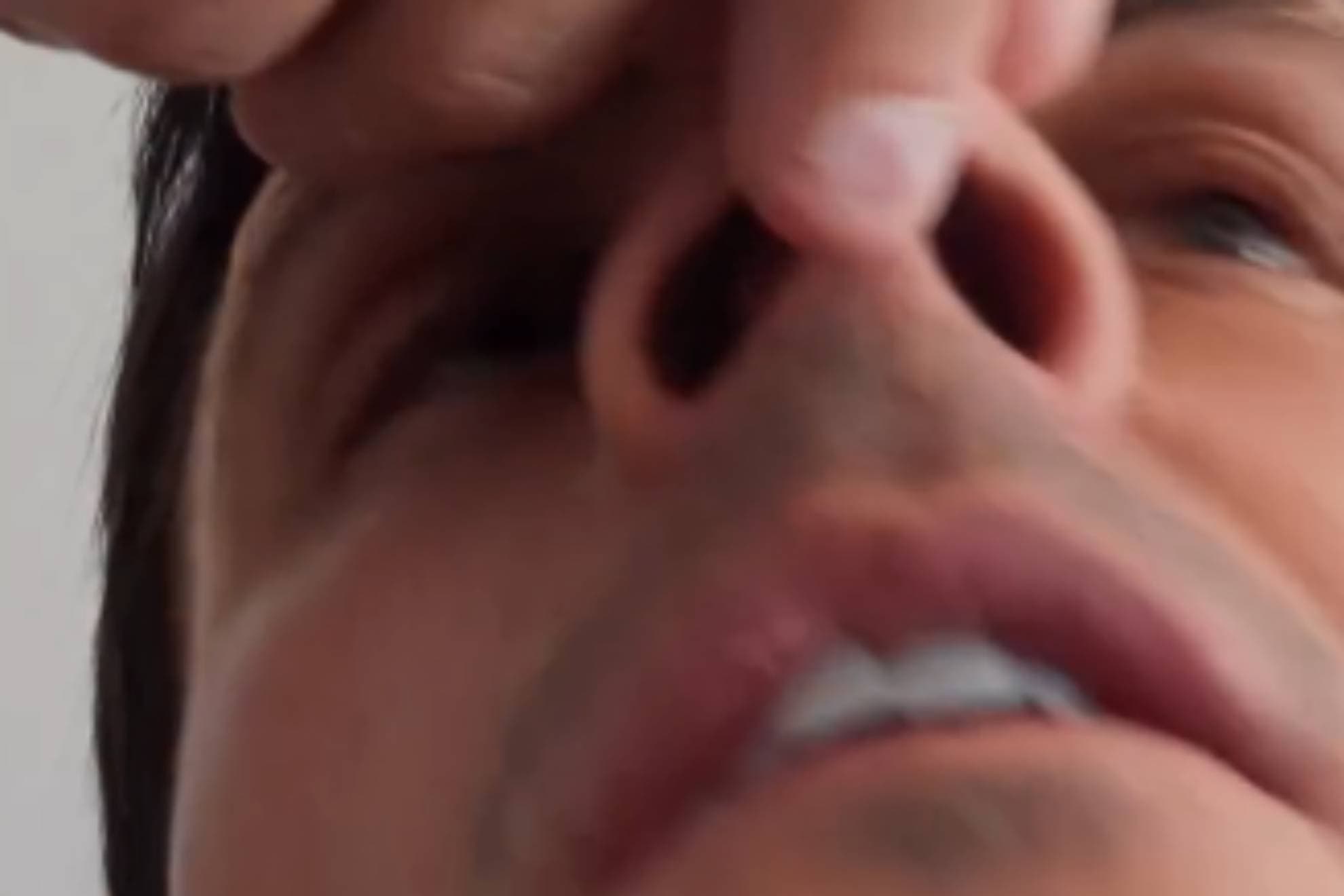 Así se le ha quedado la nariz a Edu Aguirre tras ser noqueado por Omar Montes: enseña sus cartílagos