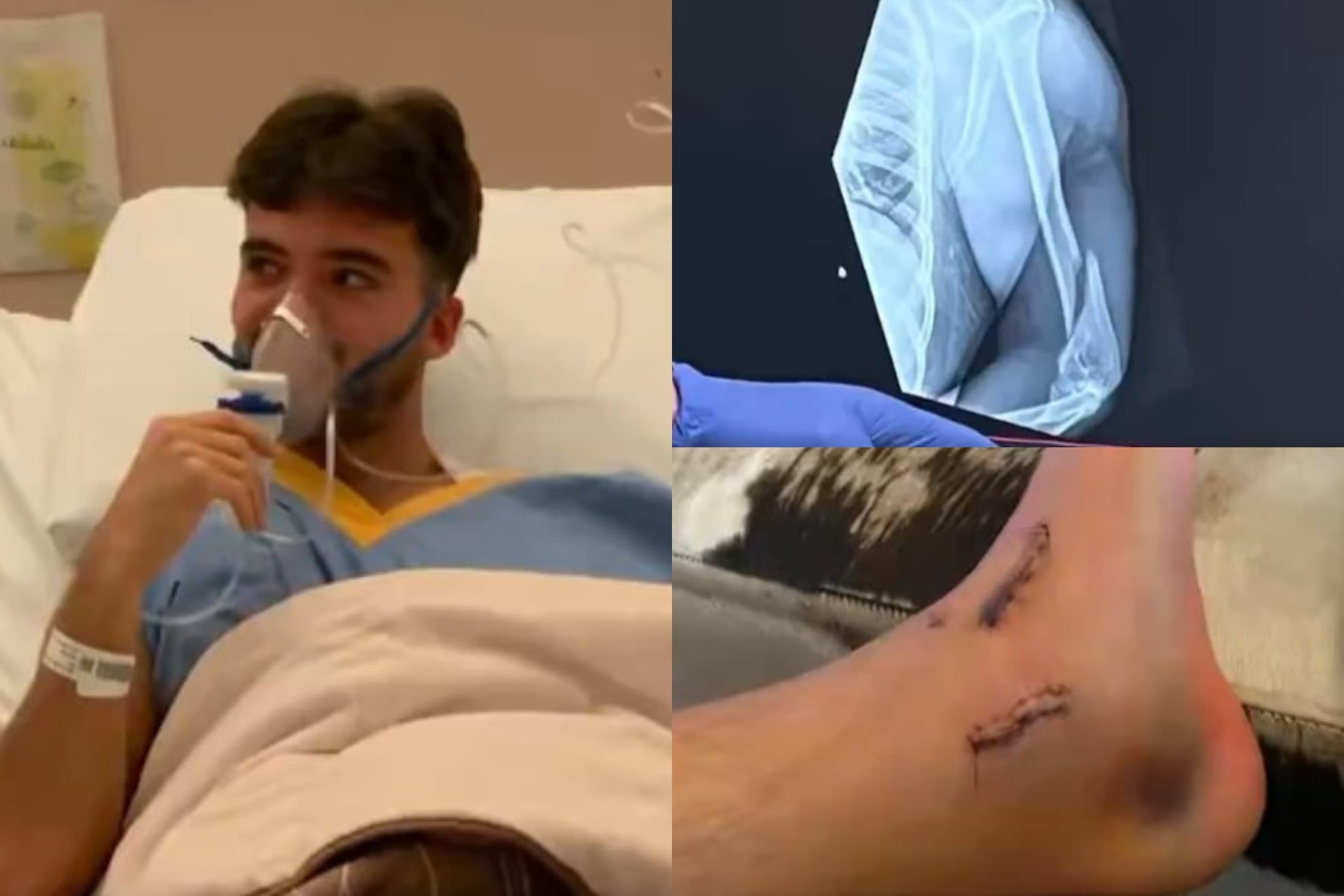 Fotos compartidas por Peeters de sus operaciones.