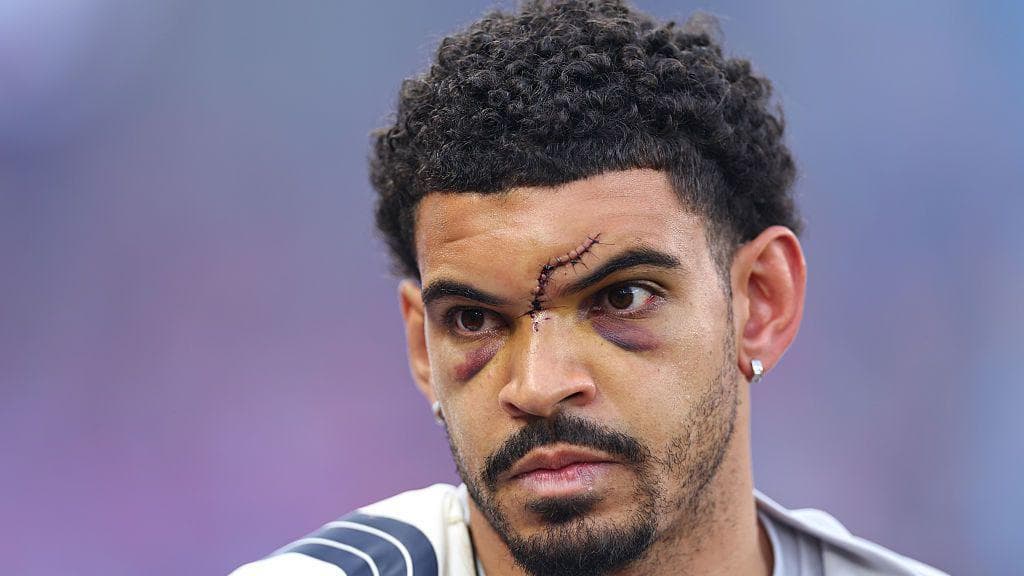 Gibbs-White a doubt for Forest run in