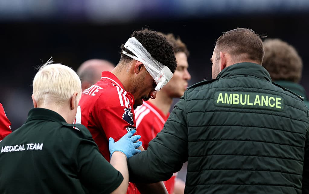 🤕Not for the squeamish: the image that stunned the Premier League
