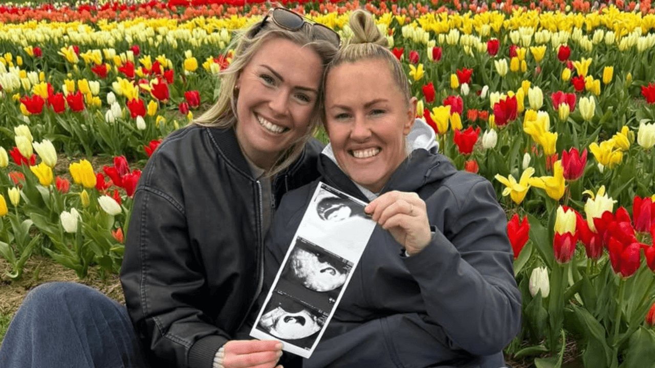 Rosie Galligan and Marlie Packer hold a picture of a pregnancy scan
