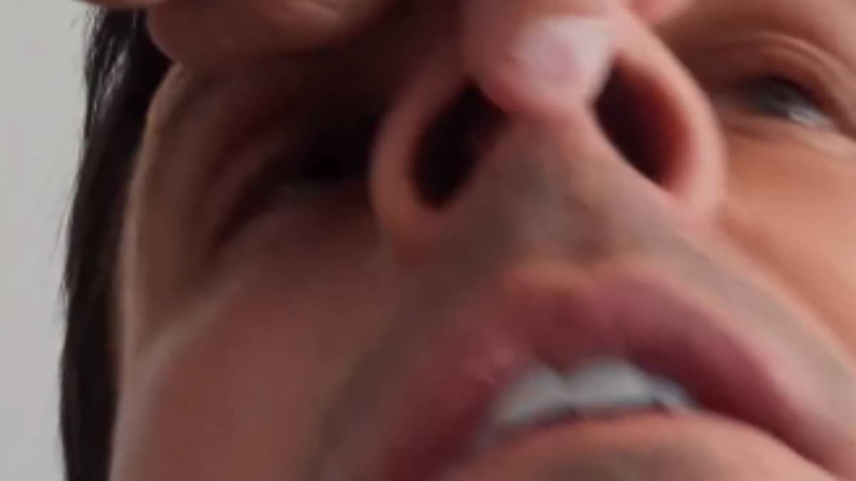 Así se le ha quedado la nariz a Edu Aguirre tras ser noqueado por Omar Montes