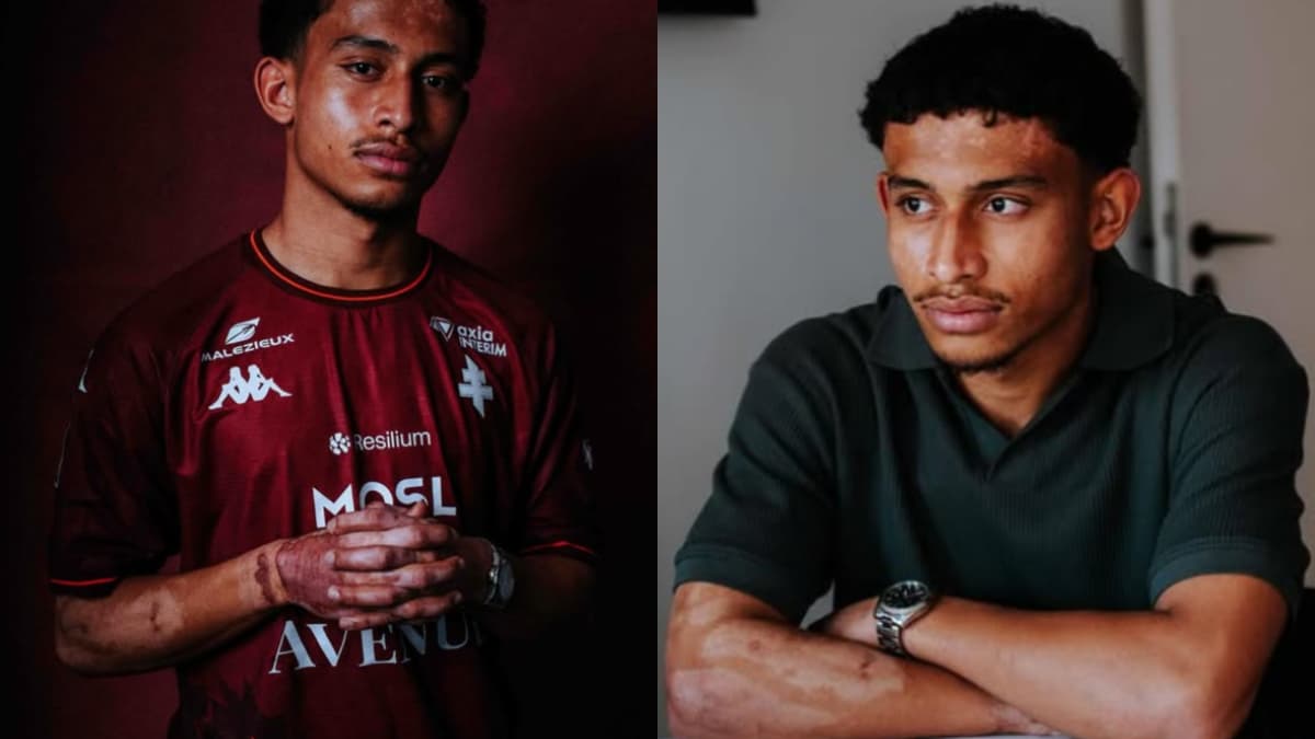 Firma con el Metz tras rescatar a su novia de un incendio mortal que le dejó quemaduras en el 30% de su cuerpo