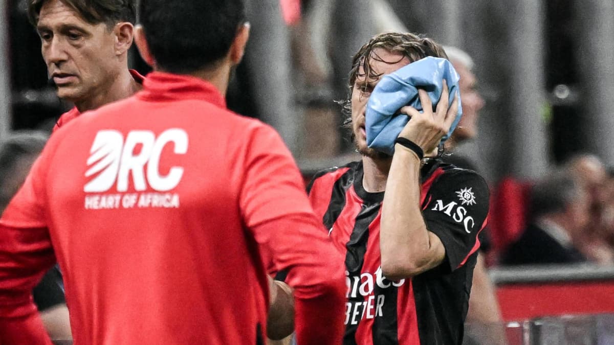 Modric, doble fractura de pómulo