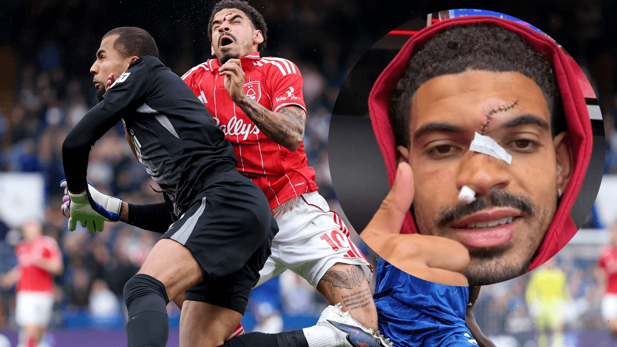 De lo peor que se ha visto en un campo de fútbol: ¡cómo se le ha quedado la cara a Gibbs-White!