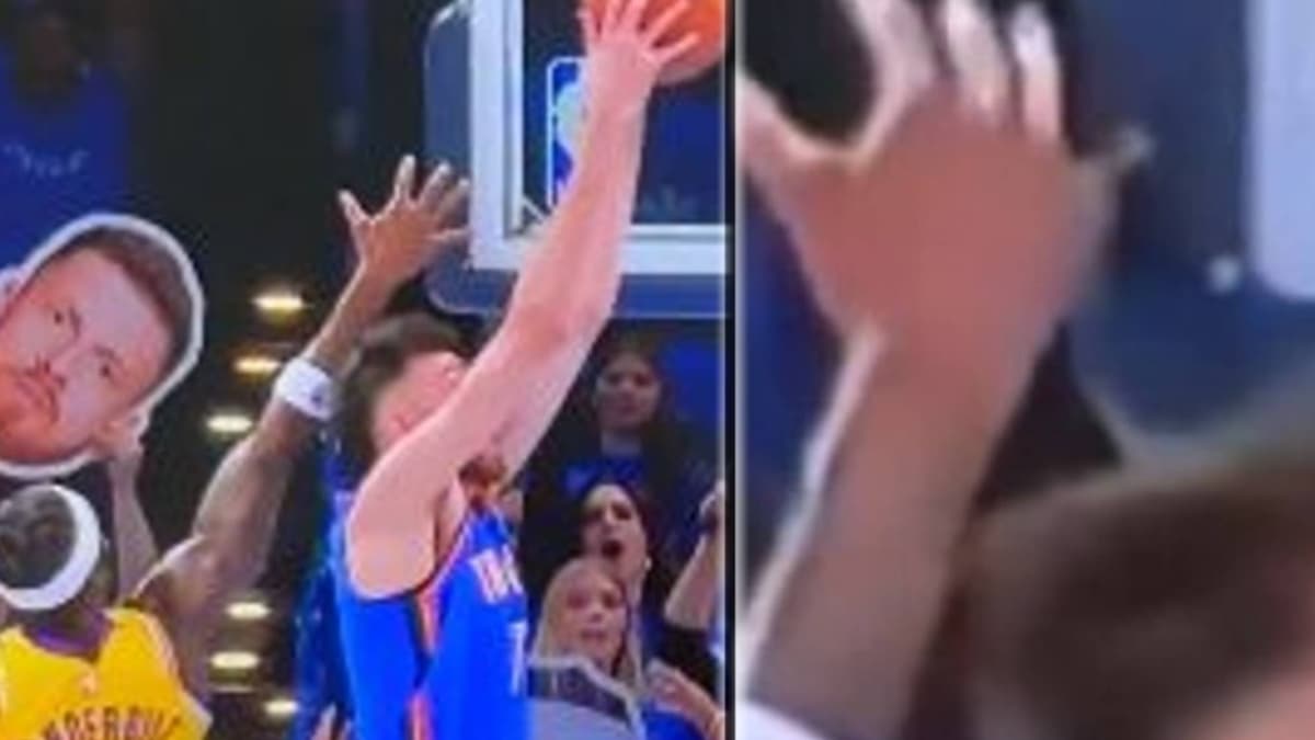 Espeluznante lesión en los Lakers: se le sale el hueso del meñique en una luxación abierta
